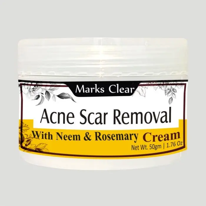 Zenvista Meditech Scars Removal, Acne Scars/ Dark Spot , All types of scars with Almond Oil,Rosemary, Vitamin B3, Grapeseed & other natural ingredients (50 g)